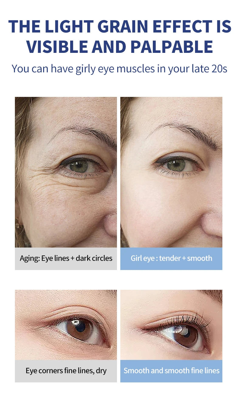 OCHEAL Electric Massage Eye Cream Hyaluronic Acid Firming Fades Fine Lines Eye Care Gel Moisturizing Beauty Eye Skin Care Beauty