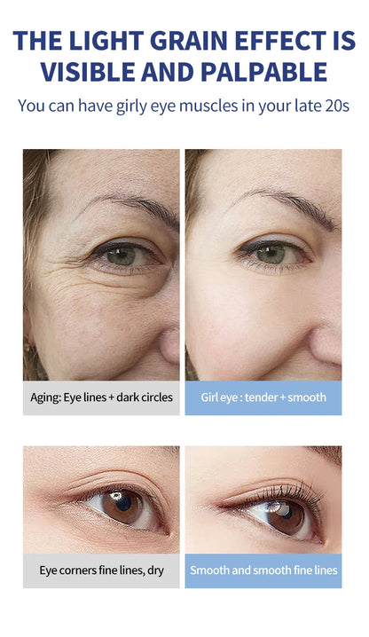 OCHEAL Electric Massage Eye Cream Hyaluronic Acid Firming Fades Fine Lines Eye Care Gel Moisturizing Beauty Eye Skin Care Beauty