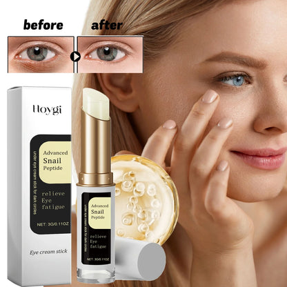 Eye Cream Remove Wrinkles Eliminate Eye Bags Dark Circles Eye Skin Care Anti Aging Whitening Moisturizing Brightening