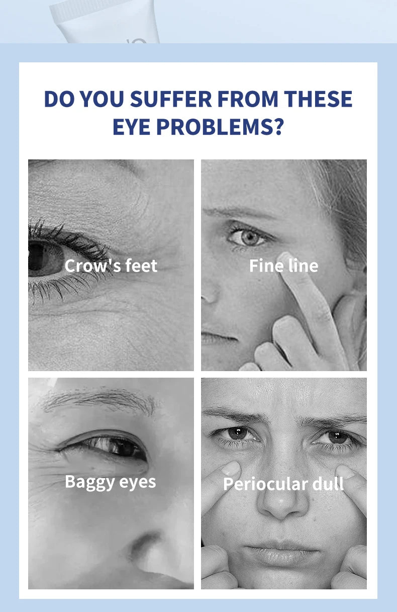 OCHEAL Electric Massage Eye Cream Hyaluronic Acid Firming Fades Fine Lines Eye Care Gel Moisturizing Beauty Eye Skin Care Beauty