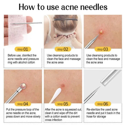 1/11Pcs Acne Pimples Blackhead Remover Clip Ultra-fine Tweezers Black Dots Blackhead Extractor Acne Needle Facial Cleaner Skin