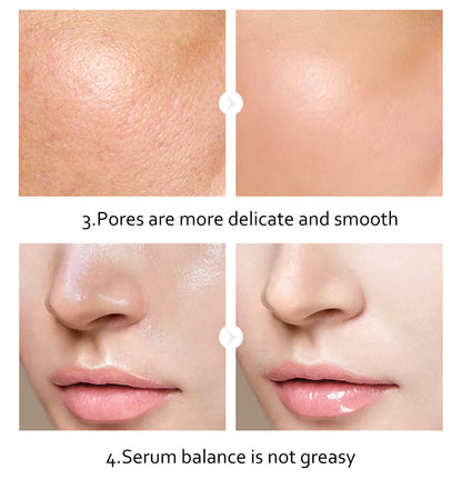 Skincare Set 24K Gold Niacinamide Face Serum Anti Ageing Skin Products Remove Dark Circles Collagen Eye Cream Skin Care Kit