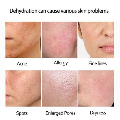 Skincare Set 24K Gold Niacinamide Face Serum Anti Ageing Skin Products Remove Dark Circles Collagen Eye Cream Skin Care Kit