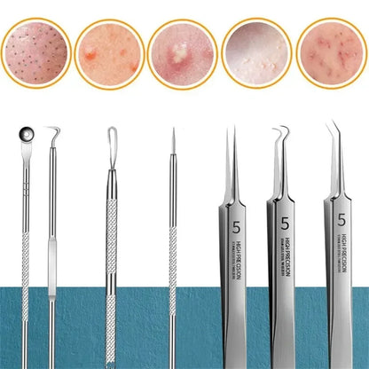 1/11Pcs Acne Pimples Blackhead Remover Clip Ultra-fine Tweezers Black Dots Blackhead Extractor Acne Needle Facial Cleaner Skin